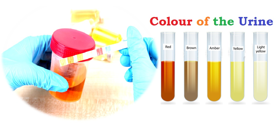 Physical and chemical examination of urine