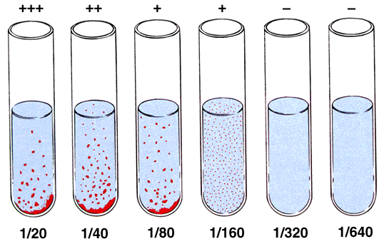 Widal tube test