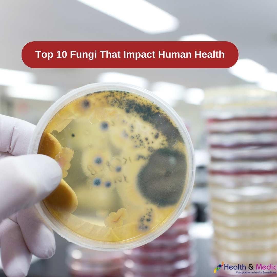 Top 10 Fungi That Impact Human Health